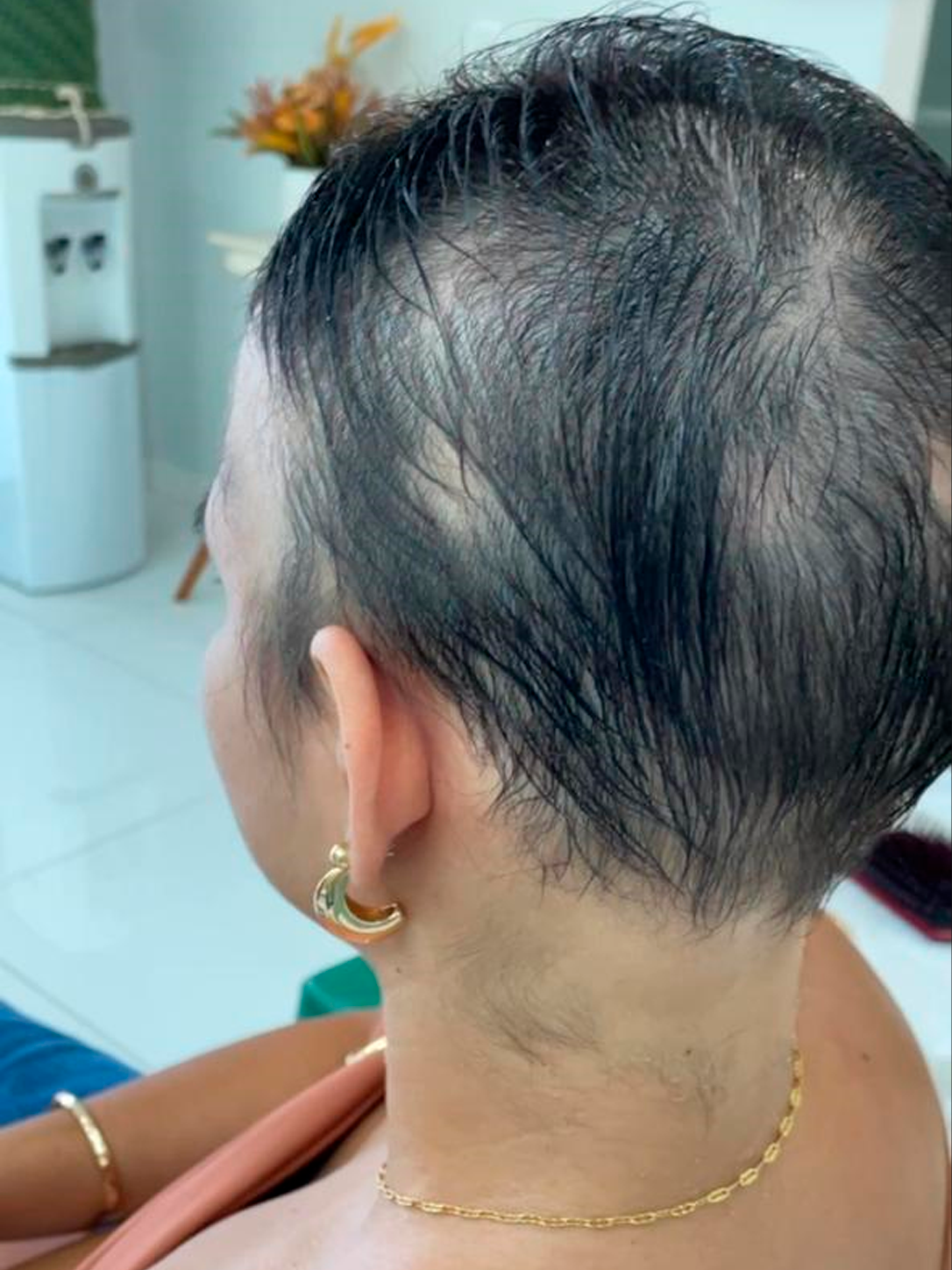 crescimento capilar feminino01
